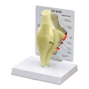 오픈메디칼GPI 무릎관절모형 G100